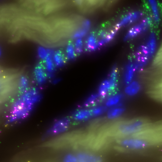 SCRINSHOT (Single Cell Resolution IN Situ Hybridization On Tissues), a multiplex RNA mapping approach